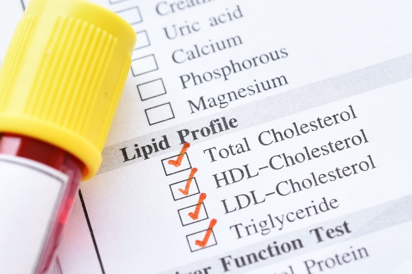 Do I need to prepare for a cholesterol test? PALS